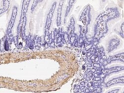 Alpha-Smooth Muscle Actin Rabbit anti-Human, Polyclonal, Invitrogen 100 &mu;L | Buy Online | Thermo Scientific | Fisher Scientific