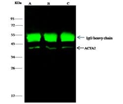 Alpha-Smooth Muscle Actin Rabbit anti-Human, Polyclonal, Invitrogen 100 &mu;L | Buy Online | Thermo Scientific | Fisher Scientific