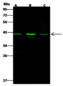 Alpha-Smooth Muscle Actin Rabbit anti-Human, Polyclonal, Invitrogen 100 &mu;L | Buy Online | Thermo Scientific | Fisher Scientific