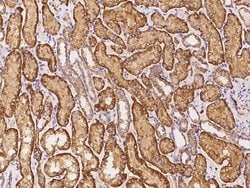 Invitrogen alpha Adducin Polyclonal Antibody 100 &mu;L; Unconjugated:Antibodies,