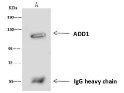 Invitrogen alpha Adducin Polyclonal Antibody 100 &mu;L; Unconjugated:Antibodies,