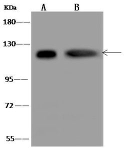 Invitrogen alpha Adducin Polyclonal Antibody 100 &mu;L; Unconjugated:Antibodies,