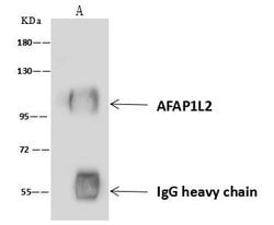Invitrogen AFAP1L2 Polyclonal Antibody 100 &mu;L; Unconjugated:Antibodies,