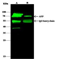 Invitrogen AFP Polyclonal Antibody 100 μL; Unconjugated:Antibodies,