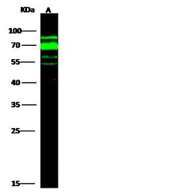 Invitrogen AFP Polyclonal Antibody 100 μL; Unconjugated:Antibodies,