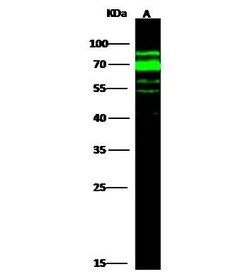 Invitrogen AFP Polyclonal Antibody 100 μL; Unconjugated:Antibodies,
