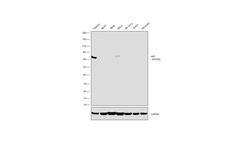 Invitrogen AFP Polyclonal Antibody 100 μL; Unconjugated:Antibodies,