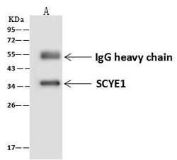 Invitrogen EMAP II Polyclonal Antibody 100 &mu;L; Unconjugated:Antibodies,