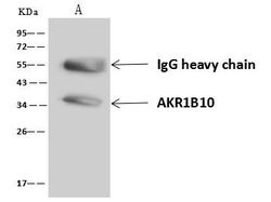 Invitrogen AKR1B10 Polyclonal Antibody 100 &mu;L; Unconjugated:Antibodies,