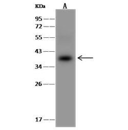 Invitrogen AKR1B10 Polyclonal Antibody 100 &mu;L; Unconjugated:Antibodies,