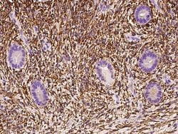 Invitrogen ALDH1A2 Polyclonal Antibody 100 &mu;L; Unconjugated:Antibodies,