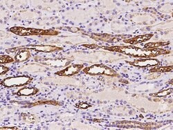 Invitrogen ALDH1A2 Polyclonal Antibody 100 &mu;L; Unconjugated:Antibodies,