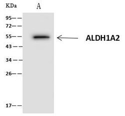 Invitrogen ALDH1A2 Polyclonal Antibody 100 &mu;L; Unconjugated:Antibodies,