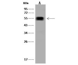 Invitrogen ALDH1A2 Polyclonal Antibody 100 &mu;L; Unconjugated:Antibodies,