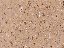 Invitrogen Apolipoprotein L2 Polyclonal Antibody 100 &mu;L | Buy Online | Invitrogen&trade; | Fisher Scientific