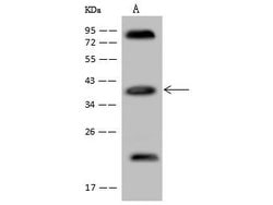 Invitrogen Apolipoprotein L2 Polyclonal Antibody 100 &mu;L | Buy Online | Invitrogen&trade; | Fisher Scientific