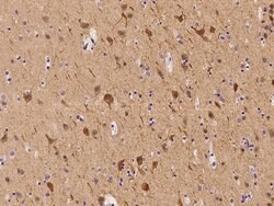 Invitrogen Apolipoprotein L2 Polyclonal Antibody 100 &mu;L | Buy Online | Invitrogen&trade; | Fisher Scientific