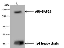 Invitrogen PARG1 Polyclonal Antibody 100 &mu;L; Unconjugated:Antibodies,