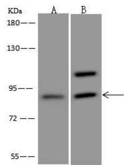 Invitrogen ASCC2 Polyclonal Antibody 100 &mu;L | Buy Online | Invitrogen&trade; | Fisher Scientific