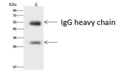 Invitrogen ASCL1 Polyclonal Antibody 100 &mu;L; Unconjugated:Antibodies,