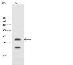 Invitrogen ASCL1 Polyclonal Antibody 100 &mu;L; Unconjugated:Antibodies,