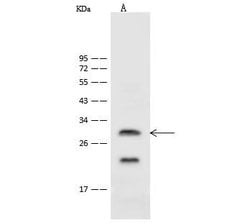 Invitrogen ASCL1 Polyclonal Antibody 100 &mu;L; Unconjugated:Antibodies,