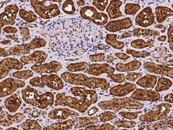 ASL Polyclonal Antibody:Antibodies, Polyclonal