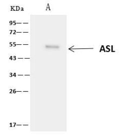 ASL Polyclonal Antibody:Antibodies, Polyclonal