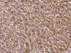 Invitrogen ASS1 Polyclonal Antibody 100 &mu;L | Buy Online | Invitrogen&trade; | Fisher Scientific