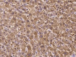Invitrogen ASS1 Polyclonal Antibody 100 &mu;L | Buy Online | Invitrogen&trade; | Fisher Scientific
