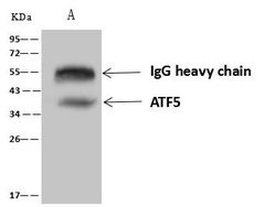 Invitrogen ATF5 Polyclonal Antibody 100 &mu;L; Unconjugated:Antibodies,