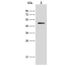 Invitrogen V-ATPase C1 Polyclonal Antibody 100 &mu;L; Unconjugated:Antibodies,