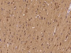 Invitrogen ATP6V1D Polyclonal Antibody 100 &mu;L; Unconjugated:Antibodies,