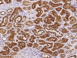Invitrogen ATP6V1D Polyclonal Antibody 100 &mu;L; Unconjugated:Antibodies,