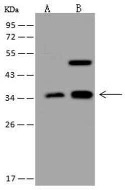 Invitrogen ATP6V1D Polyclonal Antibody 100 &mu;L; Unconjugated:Antibodies,