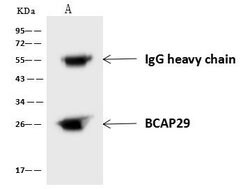 Invitrogen BAP29 Polyclonal Antibody 100 &mu;L; Unconjugated:Antibodies,