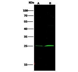 Invitrogen Bcl-2 Polyclonal Antibody 100 &mu;L | Buy Online | Invitrogen&trade; | Fisher Scientific