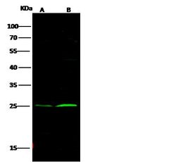 Invitrogen Bcl-2 Polyclonal Antibody 100 &mu;L | Buy Online | Invitrogen&trade; | Fisher Scientific
