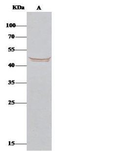 Invitrogen BLMH Polyclonal Antibody 100 &mu;L; Unconjugated:Antibodies,