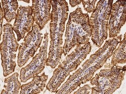 Invitrogen C1QBP Polyclonal Antibody 100 &mu;L | Buy Online | Invitrogen&trade; | Fisher Scientific