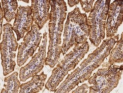 Invitrogen C1QBP Polyclonal Antibody 100 &mu;L | Buy Online | Invitrogen&trade; | Fisher Scientific