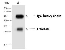 Invitrogen C9orf40 Polyclonal Antibody 100 &mu;L; Unconjugated:Antibodies,