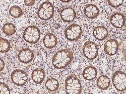 Invitrogen Calcyclin Polyclonal Antibody 100 &mu;L | Buy Online | Invitrogen&trade; | Fisher Scientific