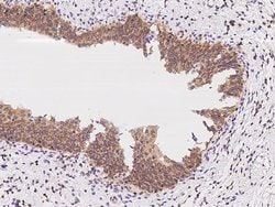 Invitrogen Calcyclin Polyclonal Antibody 100 &mu;L | Buy Online | Invitrogen&trade; | Fisher Scientific