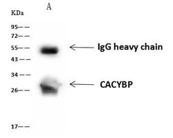 Invitrogen Calcyclin Polyclonal Antibody 100 &mu;L | Buy Online | Invitrogen&trade; | Fisher Scientific