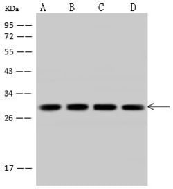 Invitrogen Calcyclin Polyclonal Antibody 100 &mu;L | Buy Online | Invitrogen&trade; | Fisher Scientific