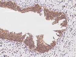 Invitrogen Calcyclin Polyclonal Antibody 100 &mu;L | Buy Online | Invitrogen&trade; | Fisher Scientific
