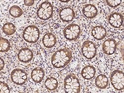 Invitrogen Calcyclin Polyclonal Antibody 100 &mu;L | Buy Online | Invitrogen&trade; | Fisher Scientific