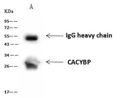 Invitrogen Calcyclin Polyclonal Antibody 100 &mu;L | Buy Online | Invitrogen&trade; | Fisher Scientific