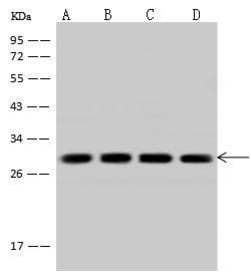 Invitrogen Calcyclin Polyclonal Antibody 100 &mu;L | Buy Online | Invitrogen&trade; | Fisher Scientific